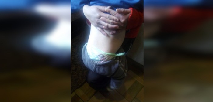 Dramática historia de niño que usa trapos y bolsas plásticas como pañales se volvió viral