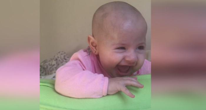 Padres de bebé con extraña enfermedad piden ayuda para costear millonaria operación