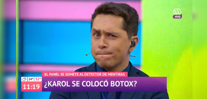 Karol Lucero (por fin) reconoció que se inyectó bótox: 