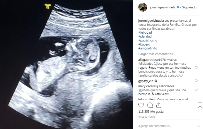 José Miguel Viñuela | Instagram
