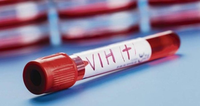 Venezolano denunció que le negaron visa por ser VIH+: Cancillería reconoció delicado error