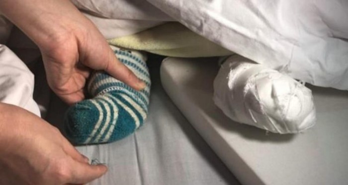 Bebé que no era bañado hace una semana sufrirá amputación de un dedo: tenía enredado un hilo