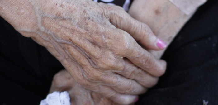 ¿No será mucho?: mujer de Angol fue al médico por dolor en su rodilla y le dieron hora para siete años más