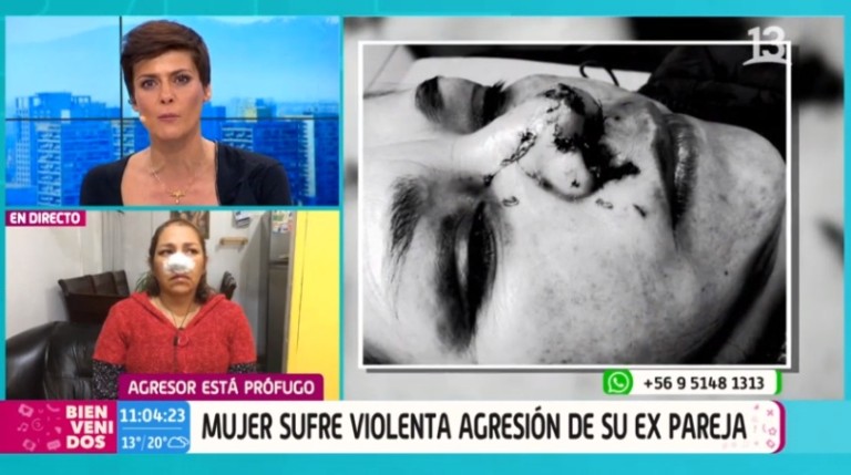 El Desgarrador Relato De Mujer Que Sufrió Brutal Agresión De Su