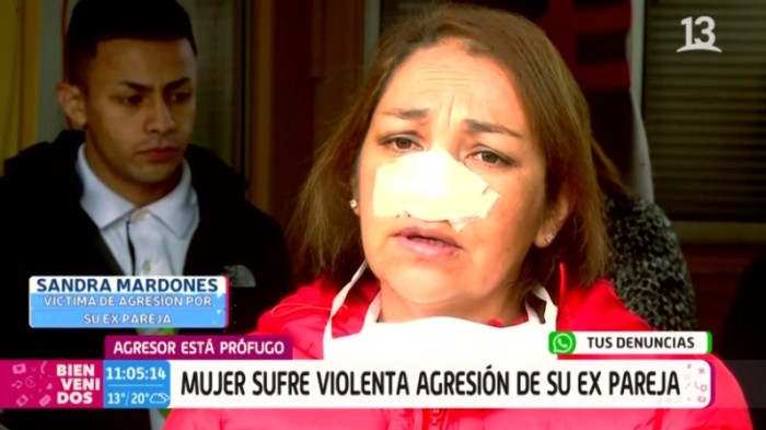 Sandra Mardones de 41 años, oriunda de Los Ángeles, quien denunció a su expareja por brutales agresiones