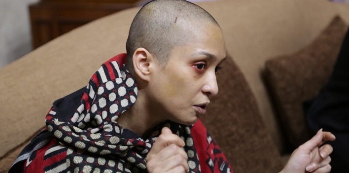 Conmoción en Pakistán: mujer fue torturada por su marido después de que ella se negara a bailarle