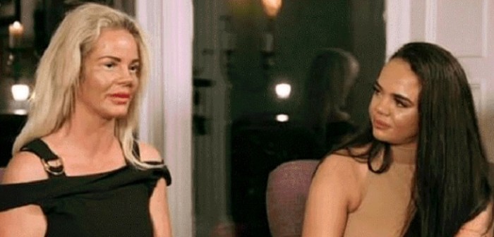 Madre inglesa prostituyó a su hija para pagar su adicción a las cirugías estéticas