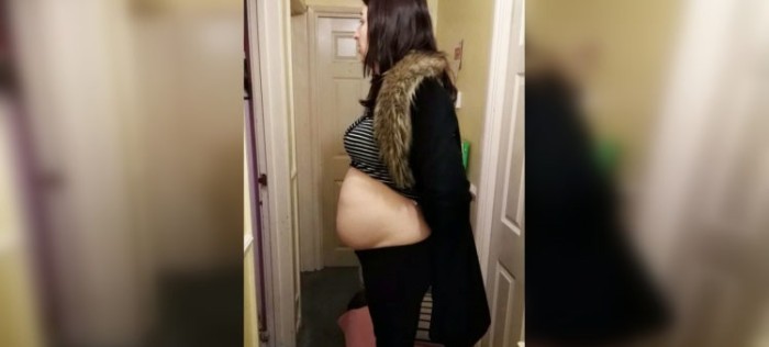 Mujer pensó que estaba embarazada pero recibió impactante diagnóstico: era un tumor de 4 kilos