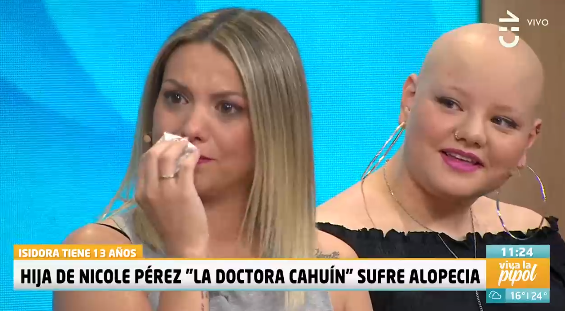 Nicole Pérez alopecia CHV viva la pipol