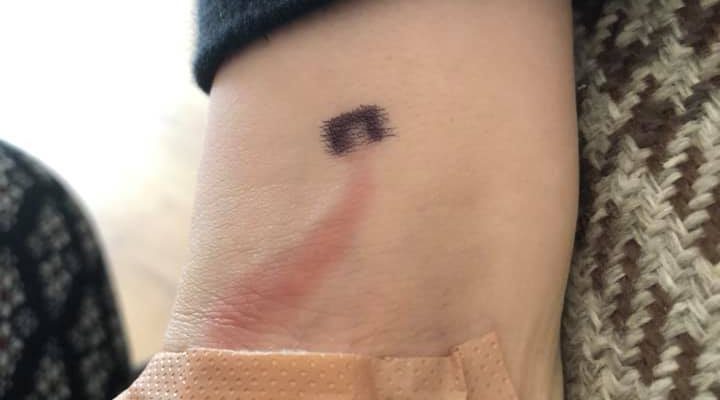 Mamá salvo vida de su hijo tras notar particular herida y fue elogiada: era una enfermedad mortal