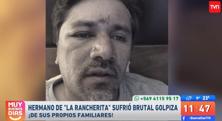 christian figueroa fue golpeado por familiares