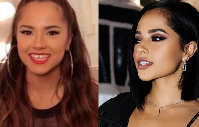 Cambio de sonrisas Becky G y Selena Gómez