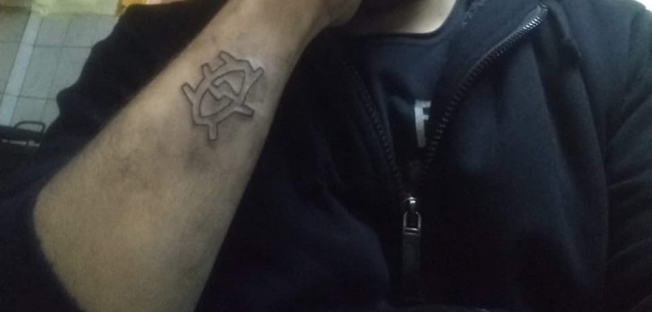 Usted no lo haga: hombre se tatuó el brazo, se arrepintió y lo borró con un rallador de queso