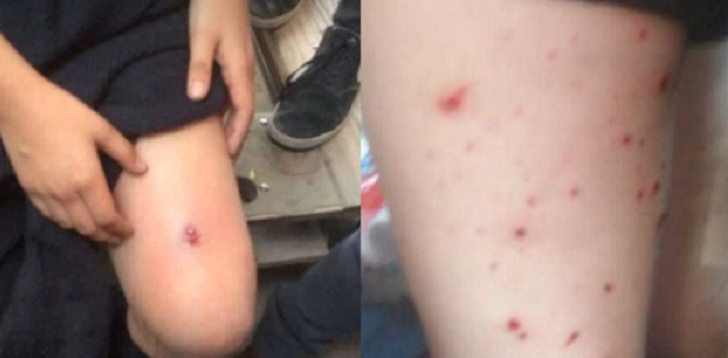 Alumnas del Liceo 7 acusan a Carabineros de ingresar disparando al recinto: dos estudiantes heridas