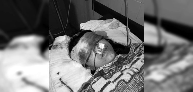 INDH interpondrá querella contra Carabineros por mujer que recibió impacto de lacrimógena en su cara