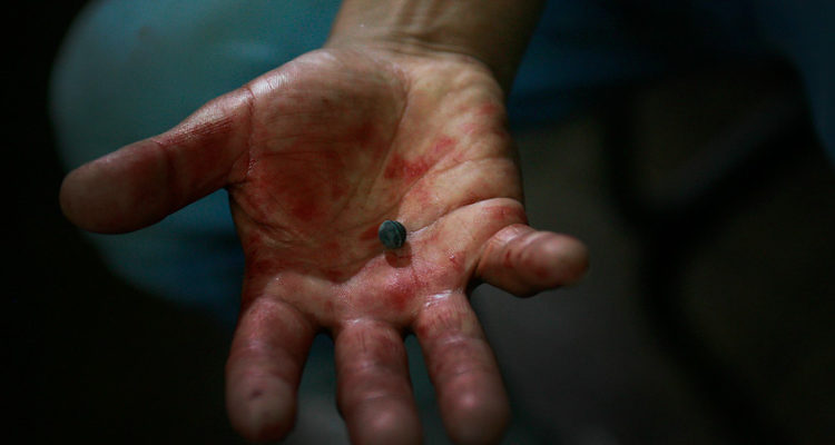 Estudio de la U. de Chile concluye que perdigones de Carabineros contienen plomo