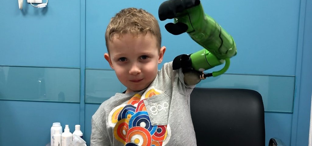 Niño pudo tomar la mano de su papá y hermano por primera vez tras recibir prótesis inspirada en Hulk
