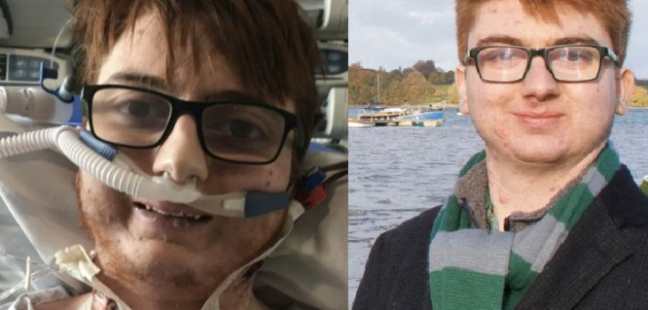 Dom Davies antes y después del trasplante de corazón