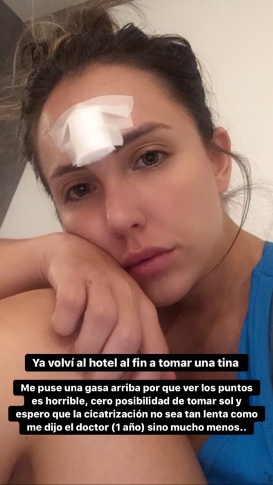 Angela Duarte sufrió accidente en Perú