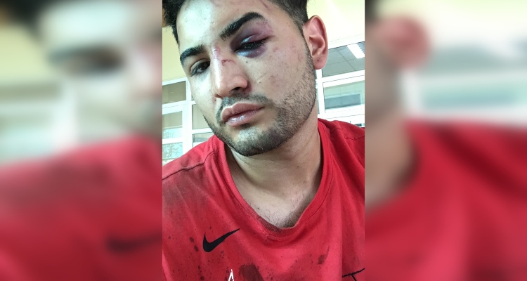 Fiscalía indaga tercera denuncia contra Carabineros por agresión en P. Alto: joven quedó fracturado