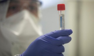 primer caso de coronavirus en Tarapacá