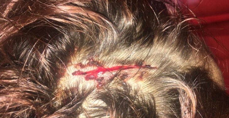 herida joven secuestrada