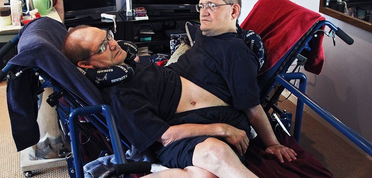 Ronnie y Donnie Galyon, los siameses más longevos del mundo, fallecieron a los 68 años