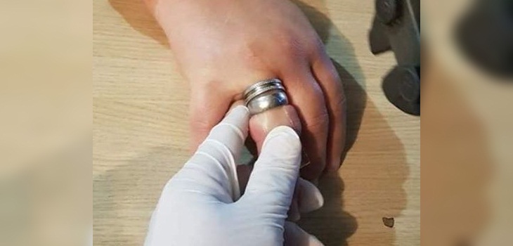 mujer anillo dedo argentina