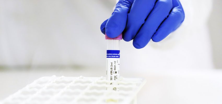 Luz verde para fase 3: laboratorios chilenos comenzarán ensayos clínicos de vacunas contra COVID-19