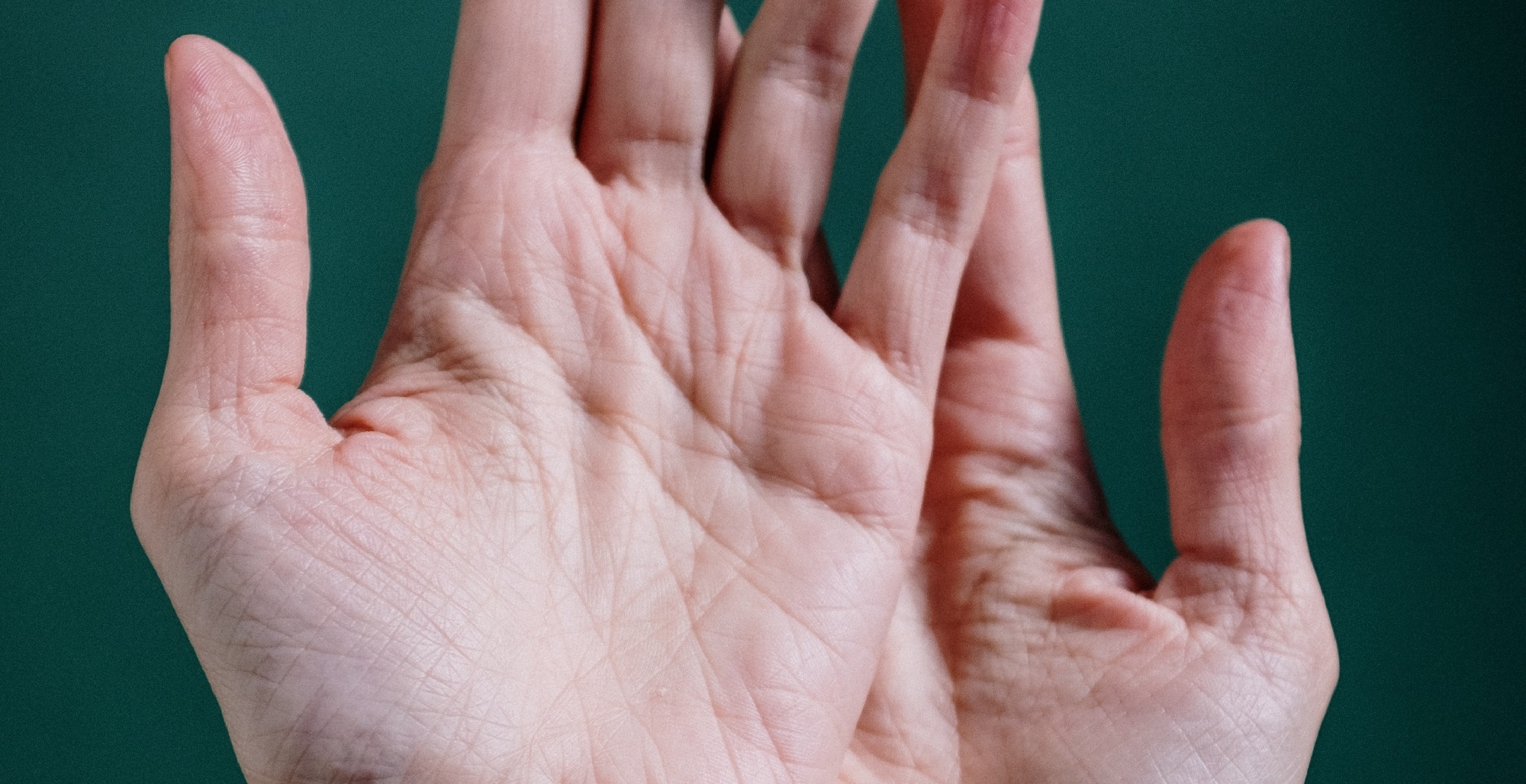 Las manos también reflejan tu edad: especialistas entregan consejos para retrasar su envejecimiento
