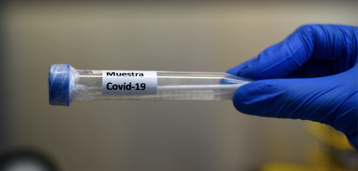 contagios por COVID-19 a nivel mundial