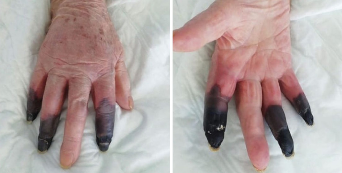 European Journal of Vascular & Endovascular Surgery