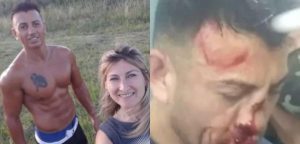 Femicida argentino sufrió brutal ataque en la cárcel: presos le desfiguraron la cara a golpes