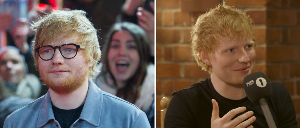 Antes y después de Ed Sheeran