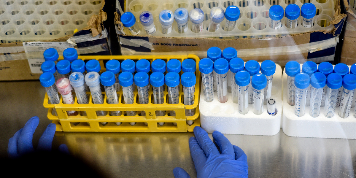 Estudio reveló que dos drogas contra la artritis reducen el riesgo de muerte por COVID-19