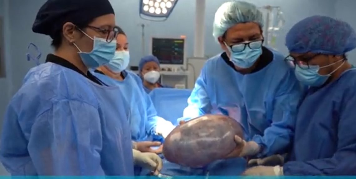 operacion mujer ecuador tumor seis kilos
