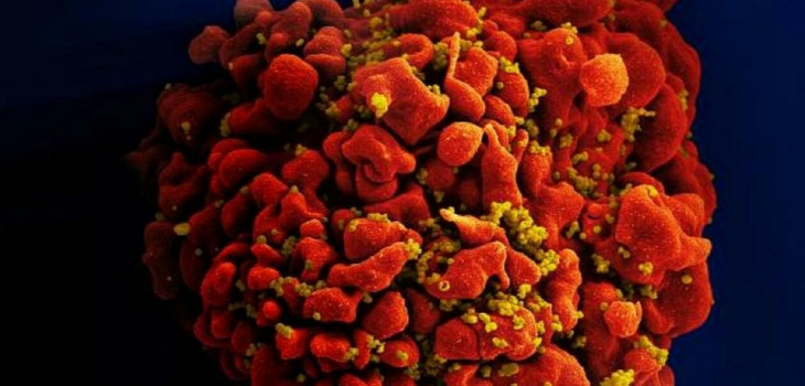 Descubren nueva variante más virulenta y transmisible del VIH