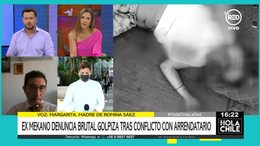 Familia de ex Mekano Romina Sáez acusó que fue víctima de brutal golpiza: recibió golpe con un bate