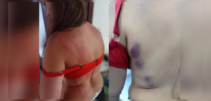 Mujer acusó a su hijo de agredirla brutalmente en varias oportunidades: “Vivo con miedo”
