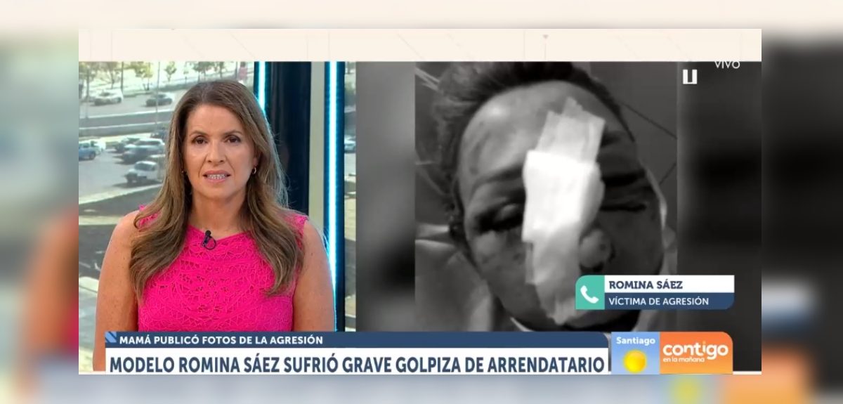 Romina Sáez conversó de su agresión en matinal de CHV