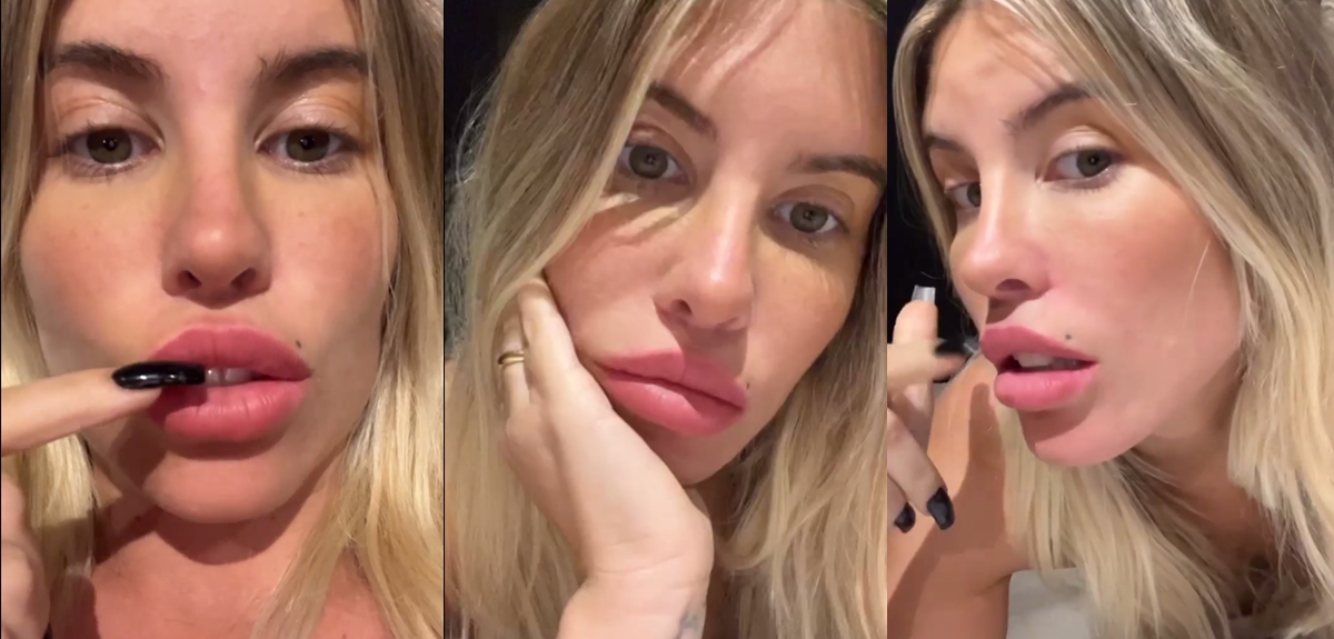 Coté López reflexionó sobre sus 'imperfecciones' mostrando sus cicatrices: 