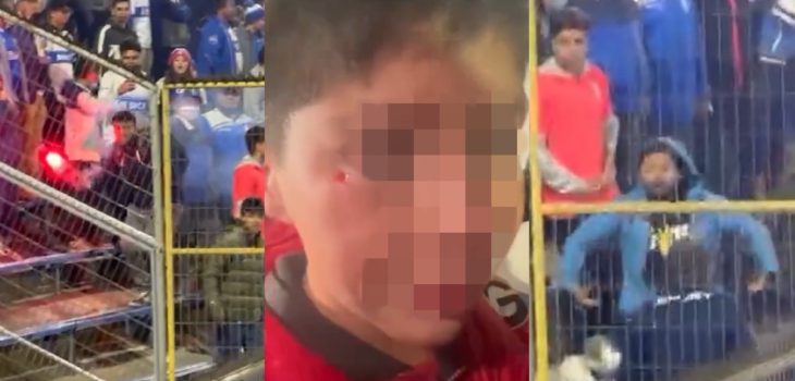 Vergonzoso: hinchas de Católica dedicaron gestos racistas y lanzaron piedra a niño de Flamengo