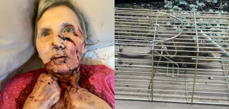 Mujer fue atacada por rata en Inglaterra.