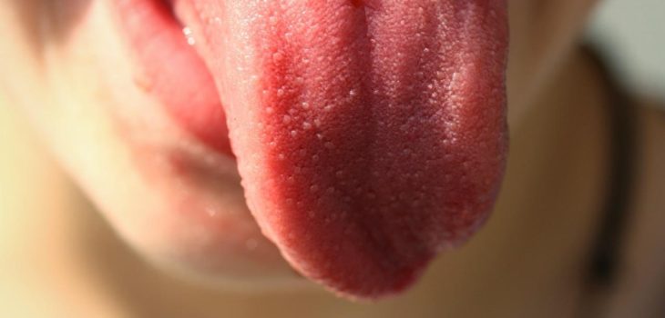 Los síntomas a los que debes estar atento para detectar un cáncer de lengua