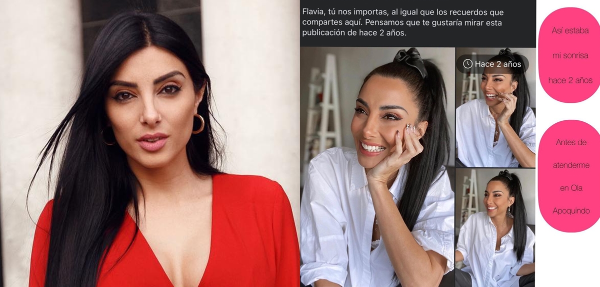 Flavia Medina acusó a clínica dental de arruinarle su sonrisa: publicó fotos del "antes y después"