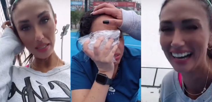 Pamela Díaz mostró su chascarro con Chiqui Aguayo: le dejó el ojo morado en partido de pádel