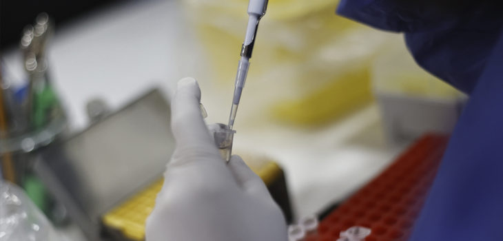 Chile registra 91 casos de viruela del mono y un hospitalizado