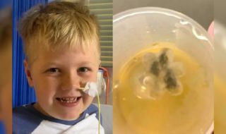 Marley Enjakovic niño 8 años juguete atrapado en su garganta