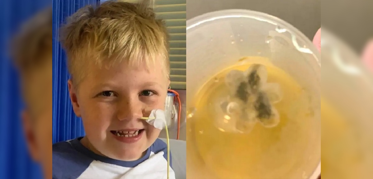 Marley Enjakovic niño 8 años juguete atrapado en su garganta