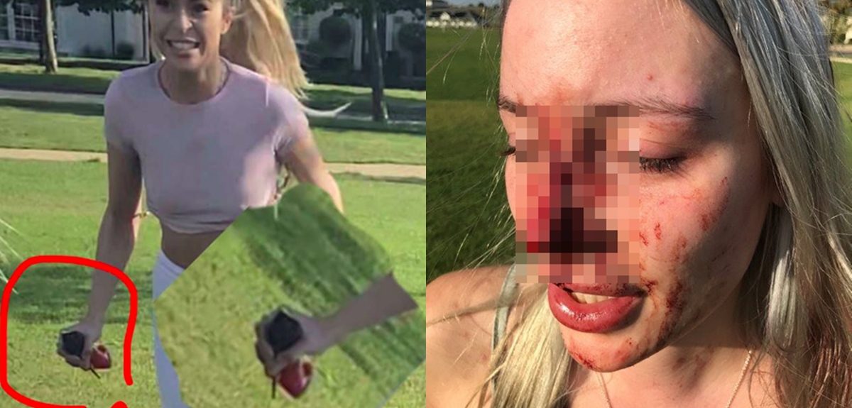 Joven atacó a expareja de su novio tras discusión en redes: usó perfume con forma de zapato stiletto
